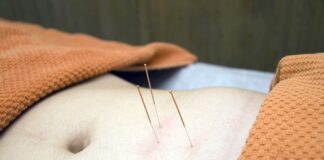 Akupunktura na odchudzanie. Zaproszenie do świata akupunktury